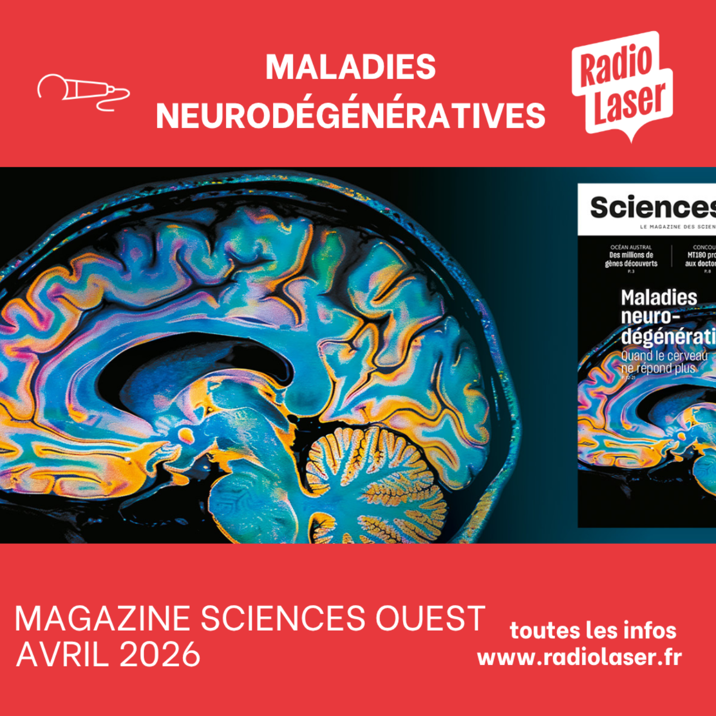 À la Cantorad –  Sciences Ouest d'Avril: maladies neurodégénératives;  " ma thèse en 180s".; génétique; dessin et sciences, etc. episode artwork